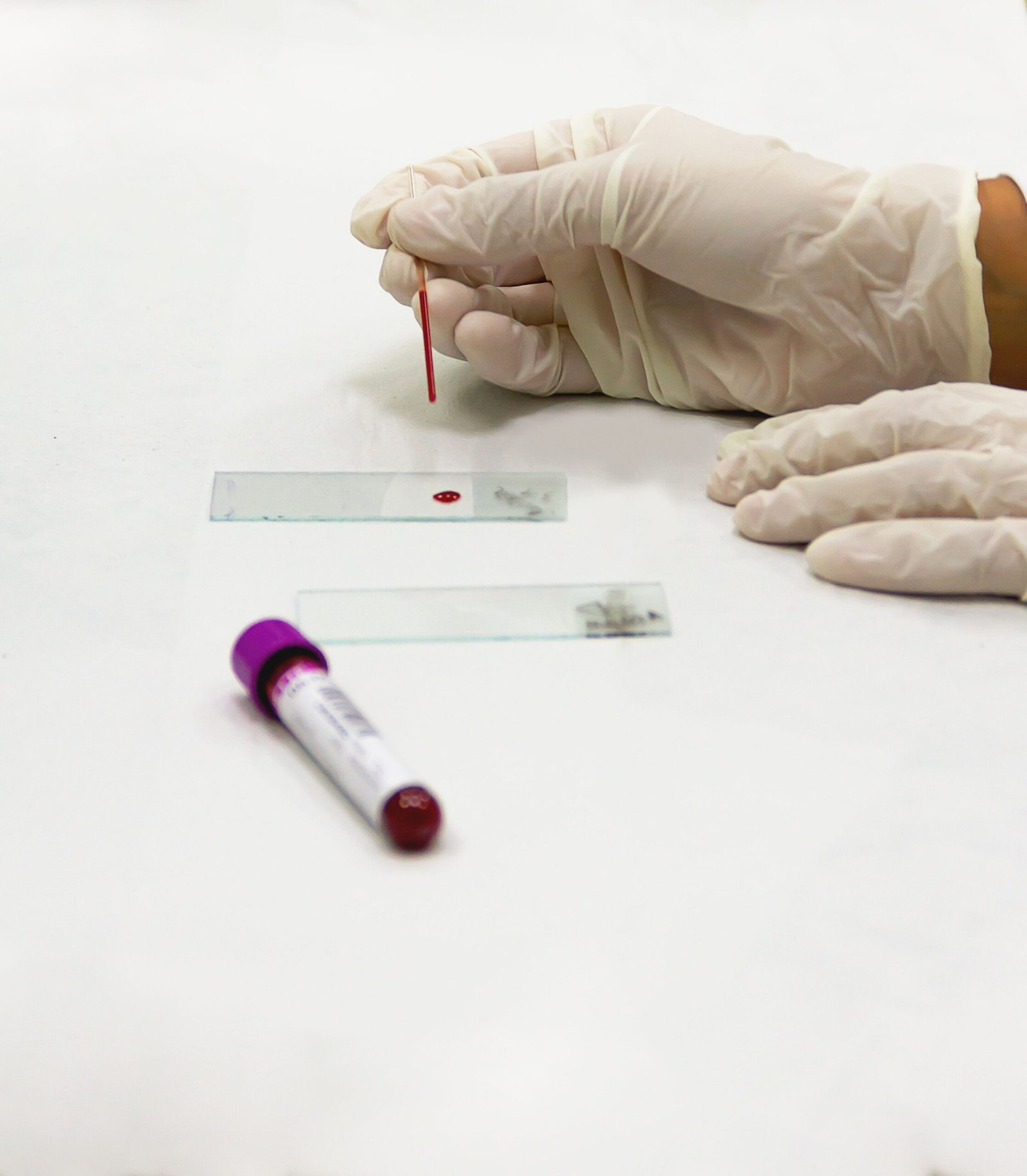Microplastics in Blood - Clinical blood analysis laboratory research tracking industrial polymer accumulation